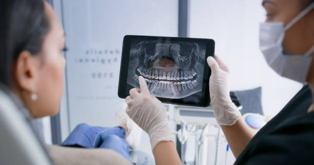 Licensed Tooth Extraction service in York, SC - Smile Center Dentistry